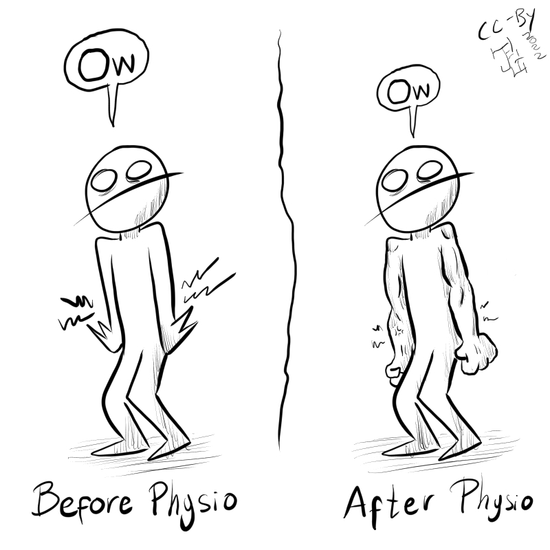 This cartoon is divided in two. The same individual is stanfing in both sides, in one their arms hurt a lot and they say 'OW', and in the other their hands hurt a bit less and are stronger, and they say 'ow'. One side is labeled 'Before Physio' and the other is labeled 'After Physio'.